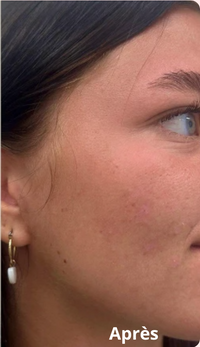Après 7 semaines avec la Crème Collagène PDRN Pink — hydratation longue durée