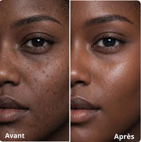 Avant / après utilisation du Masque Collagène PDRN Pink LUMEYA — peau plus lumineuse et teint unifié